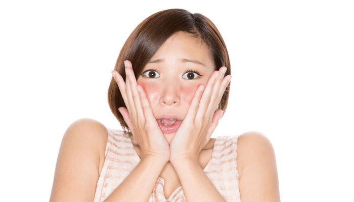Woman with excessive facial blushing shocked with her hands on her face